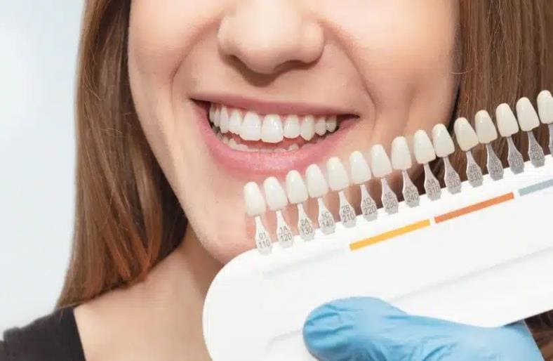 Changing Smiles: The Fashion Trend of Cosmetic Dentistry